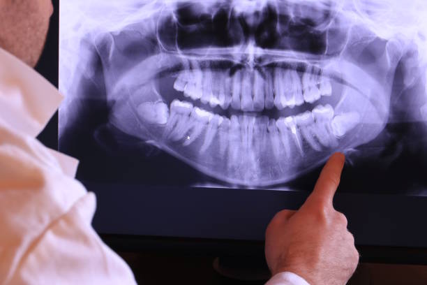 Best Emergency Treatment for Toothache in Congers, NY