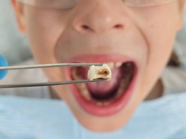 Best Emergency Treatment for Toothache in Congers, NY